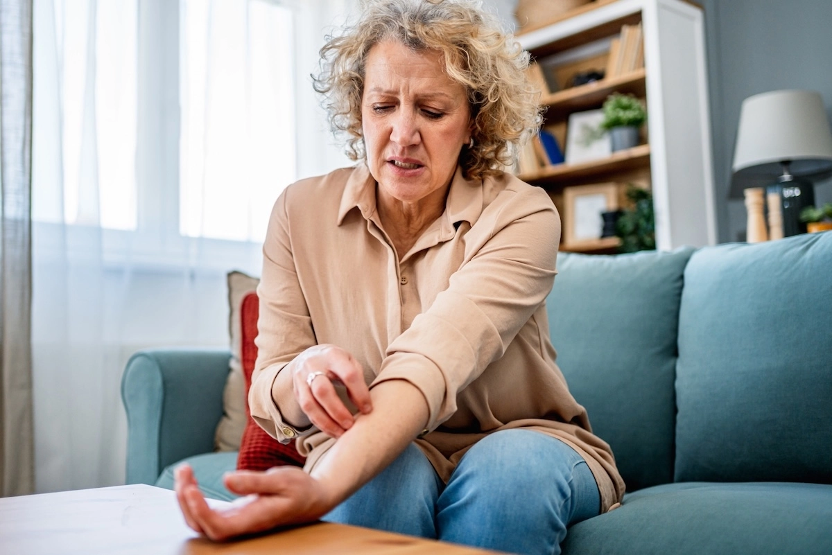 Woman scratching a rash on her arm.