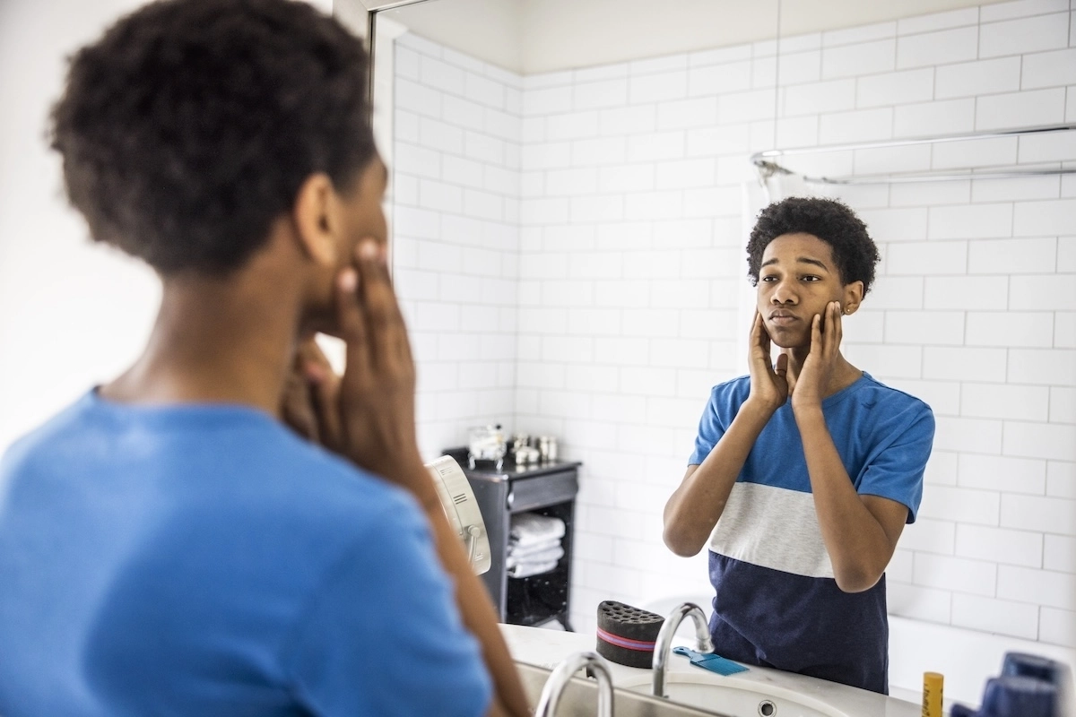 Young man checking acne in the mirror