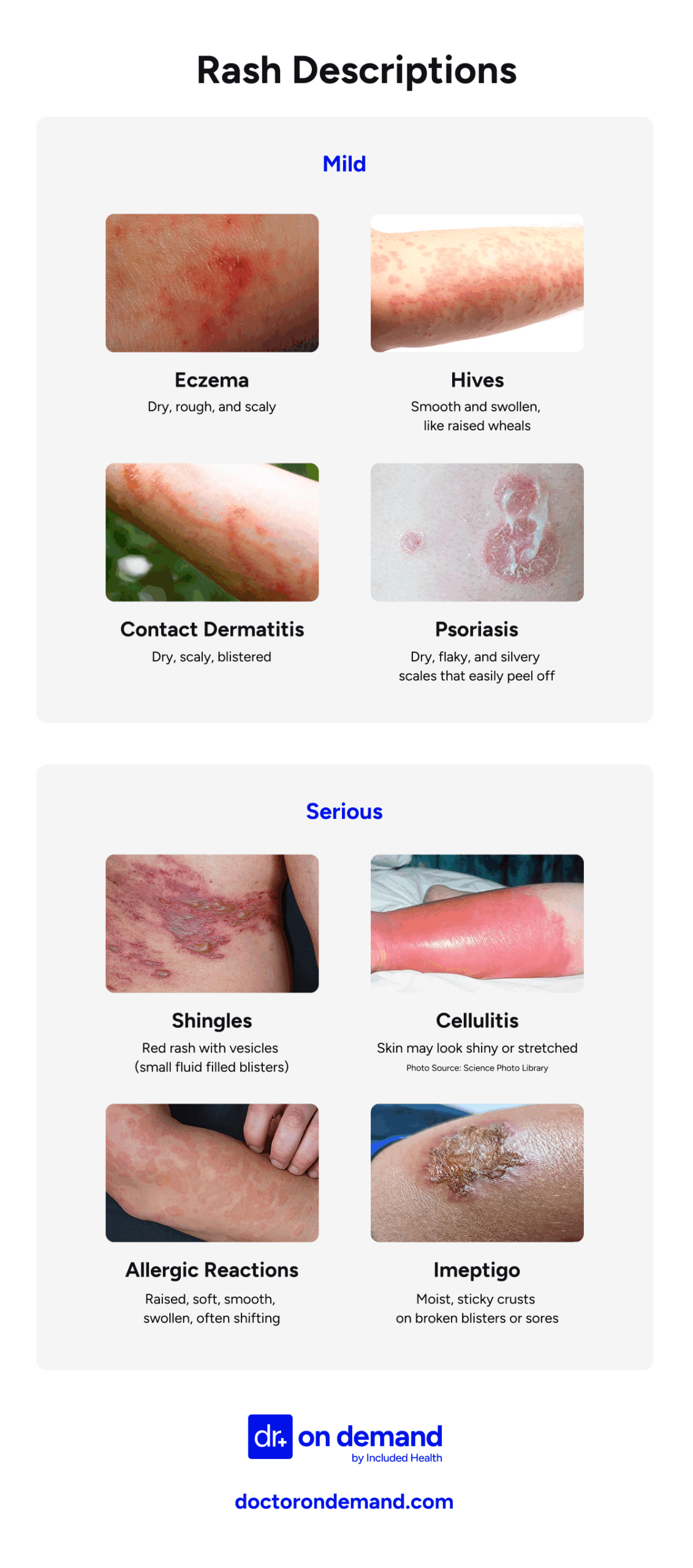 mild vs. serious skin rash examples