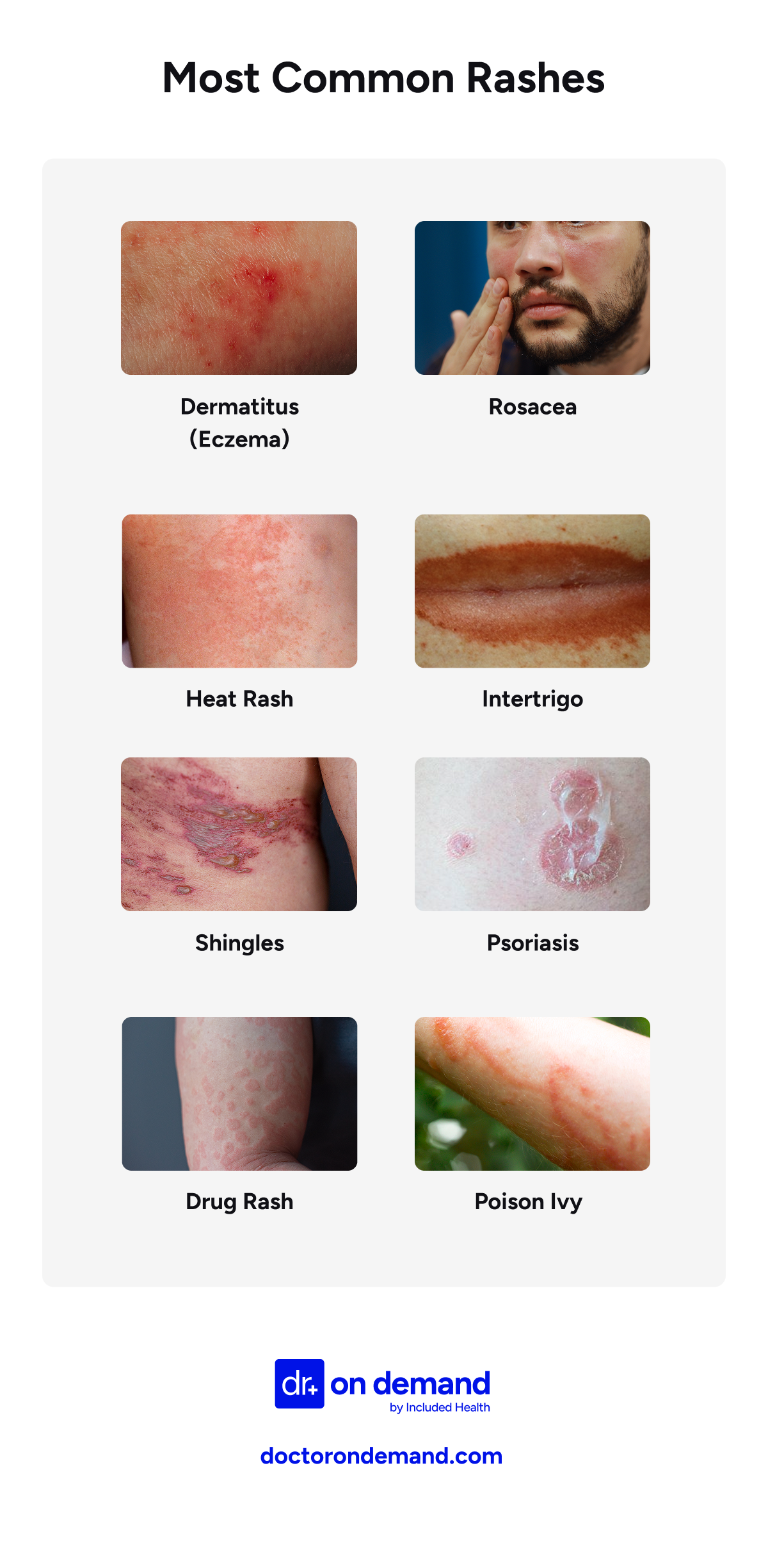 Most common skin rashes by Doctor On Demand